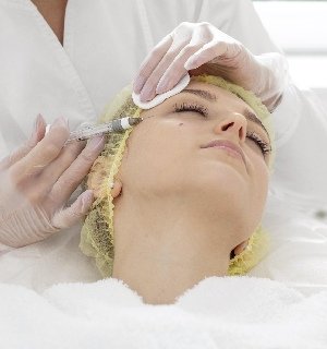 Dermal Fillers